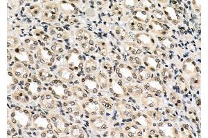ABIN6259106 and ABIN6273597 at 1/100 staining Rat kidney tissue by IHC-P.
