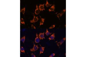 Immunofluorescence analysis of L929 cells using NDRG4 antibody  at dilution of 1:100. (NDRG4 抗体  (AA 140-220))