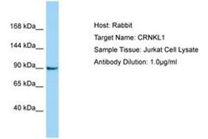 CRNKL1 抗体  (AA 760-809)