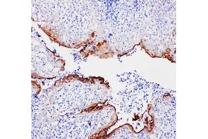 Anti-Annexin A1 antibody, IHC(P) IHC(P): Human Tonsil Tissue (Annexin a1 抗体  (N-Term))