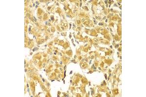 Immunohistochemistry of paraffin-embedded human gastric using SESN2 antibody at dilution of 1:100 (x400 lens). (Sestrin 2 抗体)