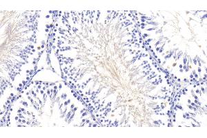 Detection of LBP in Rat Testis Tissue using Polyclonal Antibody to Lipopolysaccharide Binding Protein (LBP)