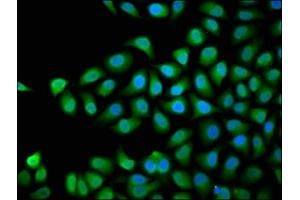 Immunofluorescence staining of Hela cells with ABIN7168754 at 1:66, counter-stained with DAPI. (DVL3 抗体  (AA 509-696))