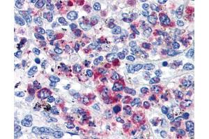 Immunohistochemistry staining of human spleen (paraffin sections) using anti-CD63 (TEM-259). (CD63 抗体)