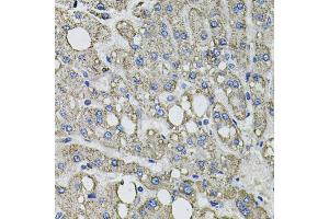 Immunohistochemistry of paraffin-embedded human liver injury using GFPT1 antibody. (GFPT1 抗体)