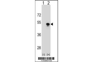 Western Blotting (WB) image for anti-Small Nuclear RNA Activating Complex, Polypeptide 1, 43kDa (SNAPC1) (AA 139-168) antibody (ABIN5537362)