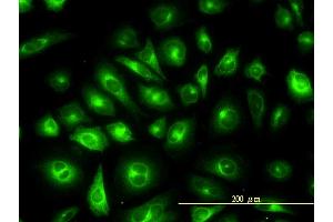 Immunofluorescence of monoclonal antibody to KRTHB1 on HeLa cell. (KRT81 抗体  (AA 1-202))