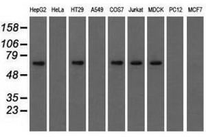 Image no. 6 for anti-Insulin-Like Growth Factor 2 mRNA Binding Protein 2 (IGF2BP2) antibody (ABIN1498822)