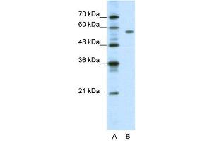 WB Suggested Anti-PBX2  Antibody Titration: 1. (PBX2 抗体  (C-Term))