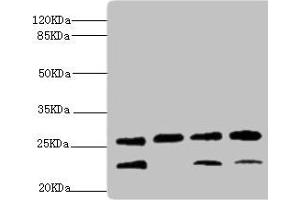Western blot All lanes: DR1 antibody at 2. (DR1 抗体  (AA 1-176))