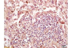 Formalin-fixed and paraffin embedded mouse embryo labeled with Rabbit Anti Lamin B Receptor Polyclonal Antibody, Unconjugated (ABIN709391) at 1:200 followed by conjugation to the secondary antibody and DAB staining (Lamin B Receptor 抗体  (AA 1-100))