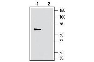 Western blot analysis of human THP-1 monocytic leukemia cells: - 1. (SLC11A1 抗体  (4th Extracellular Loop))
