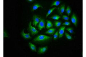 Immunofluorescence (IF) image for anti-Calcium Channel, Voltage-Dependent, beta 2 Subunit (CACNB2) (AA 490-637) antibody (ABIN7175596)