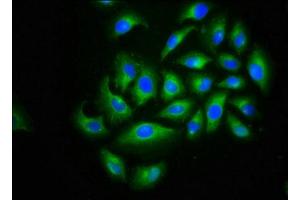 Immunofluorescence staining of A549 cells with ABIN7175596 at 1:166, counter-stained with DAPI. (CACNB2 抗体  (AA 490-637))