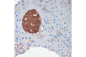 Immunohistochemistry of paraffin-embedded mouse pancreas using Somatostatin (SST) antibody (ABIN6133914, ABIN6148498, ABIN6148499 and ABIN6224956) at dilution of 1:200 (40x lens). (Somatostatin 抗体  (C-Term))