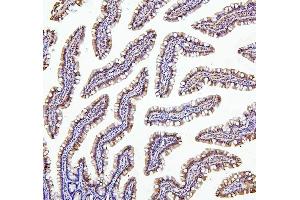 IHC analysis of TXN2 using anti-TXN2 antibody (ABIN7602150).