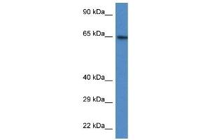 Western Blot showing ACSS2 antibody used at a concentration of 1 ug/ml against HT1080 Cell Lysate (ACSS2 抗体  (N-Term))