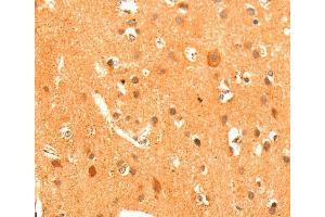 Immunohistochemistry (IHC) image for anti-Glutamate Receptor, Metabotropic 3 (GRM3) antibody (ABIN2428189) (Metabotropic Glutamate Receptor 3 抗体)
