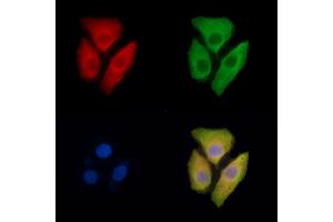 ABIN7095451 and ABIN7099508 staining Hela cells by IF/ICC.