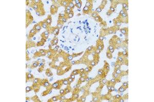 Immunohistochemistry of paraffin-embedded human liver using CCL25 antibody. (CCL25 抗体)