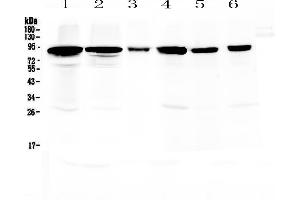 Western blot analysis of Periostin using anti-Periostin antibody . (Periostin 抗体  (AA 577-810))