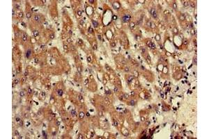 Immunohistochemistry of paraffin-embedded human liver tissue using ABIN7142740 at dilution of 1:100 (RPL12 抗体  (AA 1-99))