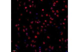 Immunofluorescence of paraffin embedded mouse corpus striatum using STRAD (ABIN7075730) at dilution of 1: 600 (400x lens) (STRADA 抗体)