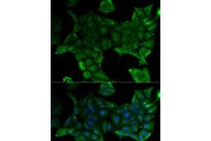 Immunofluorescence analysis of U2OS cells using SLC34A1 Polyclonal Antibody (Solute Carrier Family 34 (Type II Sodium/phosphate Contransporter), Member 1 (SLC34A1) 抗体)