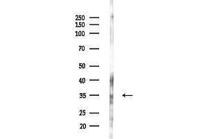 Western blot analysis of lysates from F10-LUC cells(LPS,4h treatment), using OR4P4 Antibody at 1/1000 dilution.