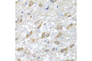 Immunohistochemistry of paraffin-embedded rat brain using HSPA6 antibody (ABIN5975621) at dilution of 1/100 (40x lens). (HSPA6 抗体)