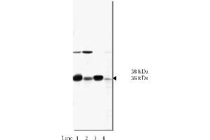 Western Blotting (WB) image for anti-N-Ethylmaleimide-Sensitive Factor Attachment Protein, alpha (NAPA) antibody (ABIN264390) (NAPA 抗体)