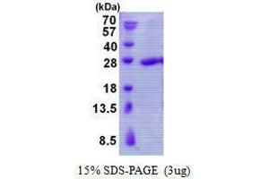 Figure annotation denotes ug of protein loaded and % gel used. (TBPL1 蛋白)