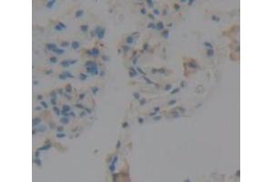 IHC-P analysis of Human Tissue, with DAB staining. (Peroxidasin 抗体  (AA 1285-1475))