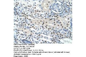 Rabbit Anti-SEMG1 Antibody  Paraffin Embedded Tissue: Human Kidney Cellular Data: Epithelial cells of renal tubule Antibody Concentration: 4. (SEMG1 抗体  (N-Term))