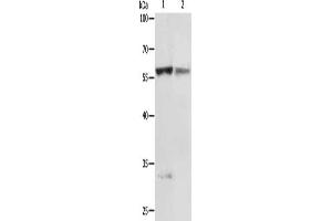 Gel: 10 % SDS-PAGE, Lysate: 50 μg, Lane 1-2: Jurkat cells, human fetal liver tissue, Primary antibody: ABIN7130695(PRCP Antibody) at dilution 1/200, Secondary antibody: Goat anti rabbit IgG at 1/8000 dilution, Exposure time: 5 minutes (PRCP 抗体)