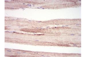 Immunohistochemistry (IHC) image for anti-Tripartite Motif Containing 63 (TRIM63) (AA 293-304) antibody (ABIN5542661)