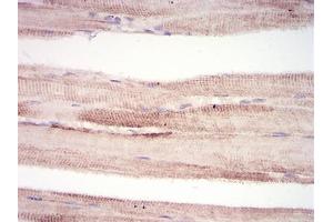 Immunohistochemical analysis of paraffin-embedded muscle tissues using MuRF1 mouse mAb with DAB staining. (TRIM63 抗体  (AA 293-304))
