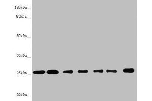 Western blot All lanes: RALB antibody at 1. (RALB 抗体  (AA 1-206))