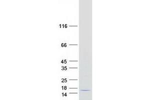 Western Blotting (WB) image for Melanoma Inhibitory Activity (MIA) protein (Myc-DYKDDDDK Tag) (ABIN2725962)