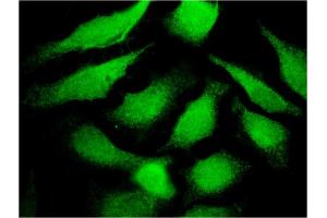 Immunofluorescence of monoclonal antibody to TF on HeLa cell. (Transferrin 抗体  (AA 551-650))