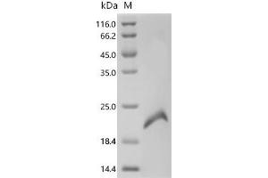 (Tris-Glycine gel) Discontinuous SDS-PAGE (reduced) with 5 % enrichment gel and 15 % separation gel.