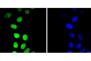 HepG2 cells were stained with Cyclin E1(T77) (4G10 ) Monoclonal Antibody  at [1:200] incubated overnight at 4C, followed by secondary antibody incubation, DAPI staining of the nuclei and detection. (Cyclin E1 抗体  (pThr77))