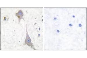 Immunohistochemistry analysis of paraffin-embedded human brain tissue, using mGluR7 Antibody. (GRM7 抗体  (AA 866-915))
