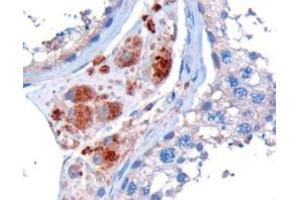 ABIN185178 (10µg/ml) staining of paraffin embedded Human Testis. (STK35 抗体  (C-Term))