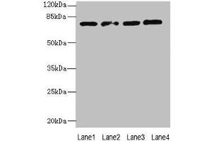 Western blot All lanes: TBC1D14 antibody at 4 μg/mL Lane 1: K562 whole cell lysate Lane 2: U87 whole cell lysate Lane 3: A549 whole cell lysate Lane 4: HepG2 whole cell lysate Secondary Goat polyclonal to rabbit IgG at 1/10000 dilution Predicted band size: 79, 48 kDa Observed band size: 79 kDa (TBC1D14 抗体  (AA 136-435))