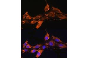 Immunofluorescence analysis of NIH/3T3 cells using  Rabbit pAb (ABIN7265482) at dilution of 1:100. (ARF4 抗体  (AA 1-180))