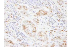 Immunohistochemistry (IHC) image for anti-Polymerase (DNA-Directed), delta 3, Accessory Subunit (POLD3) (AA 325-375) antibody (ABIN7448732)