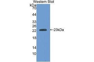 Western Blotting (WB) image for anti-Slow Skeletal Troponin I (TNNI1) (AA 142-187) antibody (ABIN1176053) (TNNI1 抗体  (AA 142-187))