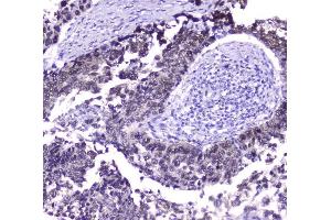 IHC analysis of Hsp70 using anti-Hsp70 antibody (ABIN5693238).