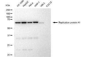 Western blotting analysis using Replication protein A1 antibody (ABIN7800172). (Recombinant RPA1 抗体)